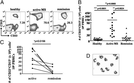 FIGURE 6. G-MDSCs are enriched in the periphery of active MS patients. Frequency (A) and relative numbers (B) of CD33+CD15+ MDSCs in the peripheral blood of MS patients with active disease (n = 14) or in remission (n = 17), as well as healthy individuals (n = 26). Gates were set on HLA-DR−/lowCD14−CD33+CD15+ cells. In the active MS group, ▪ represents patients with first episode, whereas ● represents those in relapse. C, Longitudinal course of CD33+CD15+ MDSCs in MS patients during active disease and 6 mo after the last relapse (remission). Each line represents an individual patient; p value was calculated using the Wilcoxon signed-rank test. D, May–Grunwald–Giemsa staining of sorted CD33+CD15+ MDSCs. Original magnification ×60.