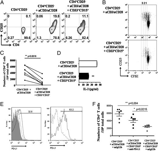 FIGURE 7. CD33+CD15+ MDSCs from active MS patients potently suppress the proliferation of autologous T cells in vitro. A, Sorted CD33+CD15+ MDSCs from active MS patients (purity > 95%) were cocultured with autologous CD4+CD25− T cells (purity > 98%) with plate-bound anti-CD3 (1 μg/ml) and anti-CD28 (1 μg/ml) for 72 h. Dot plots show CD4 versus CD25 on gated viable CD4+ T cells. Representative results are shown of at least three independent experiments. B, CFSE dilution of CD4+ T cells, cultured as in A, in the absence (top panel) or presence (bottom panel) of MDSCs after 5 d of coculture. Numbers indicate cell divisions. C, CD4+ T cell counts after 5 d of stimulation in the presence or absence of MDSCs. The p value was calculated using the t test. D, Culture supernatants were collected after 48 h and assessed for the presence of IL-2 by ELISA (mean ± SD). **p = 0.0018, t test. E, Representative graphs for PD-L1 expression on CD33+CD15+ MDSCs from healthy individuals (dashed line) and active MS patients (solid line) (left panel) or untreated (dashed line) and recombinant human IFN-γ–treated (solid line; 20 ng/ml) MDSCs isolated from active MS patients (right panel). Shaded graph represents isotype control Ab. Data are representative of four independent experiments. F, Autologous CD4+CD25− T cells from active MS patients were cocultured with CD33+CD15+ MDSCs, as described in A. Blocking anti-human PD-L1 (10 μg/ml) or isotype mouse IgG2b control (10 μg/ml) was added, as indicated. CD4+ T cells were enumerated after 5 d of stimulation. The p values were calculated using the t test.