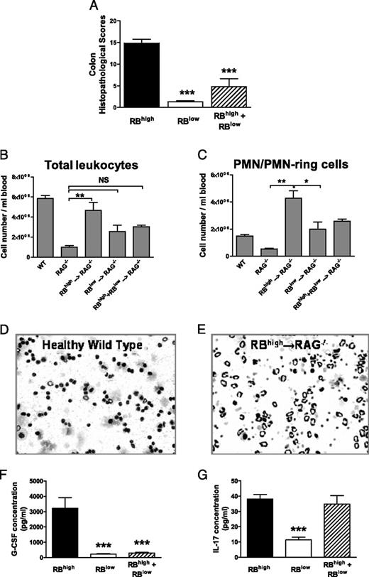 FIGURE 1. Development of chronic colitis is accompanied by enhanced myelopoiesis and increase in peripheral granulocyte numbers. A, Blinded histopathological scores of colons obtained from CD45RBhigh→RAG−/−, CD45RBlow→RAG−/−, and CD45RBhigh+CD45RBlow→RAG−/− mice for at least 11 animals/group from at least two independently conducted experiments. B, Total leukocyte numbers in peripheral blood of mice from the different groups. Blood leukocyte counts in mice were determined as described in Materials and Methods. C, Total numbers of PMNs/PMN-ring cells in peripheral blood in mice. Representative images of peripheral blood cytospins from WT (D) and colitic CD45RBhigh→RAG−/− (E) mice showing dramatic increases in peripheral blood granulocytes. Serum from 7 to 11 individual mice/group was analyzed for G-CSF (F) and IL-17 (G). Data in all graphs shown represent the mean ± SEM. *p < 0.05, **p < 0.01, ***p < 0.001.