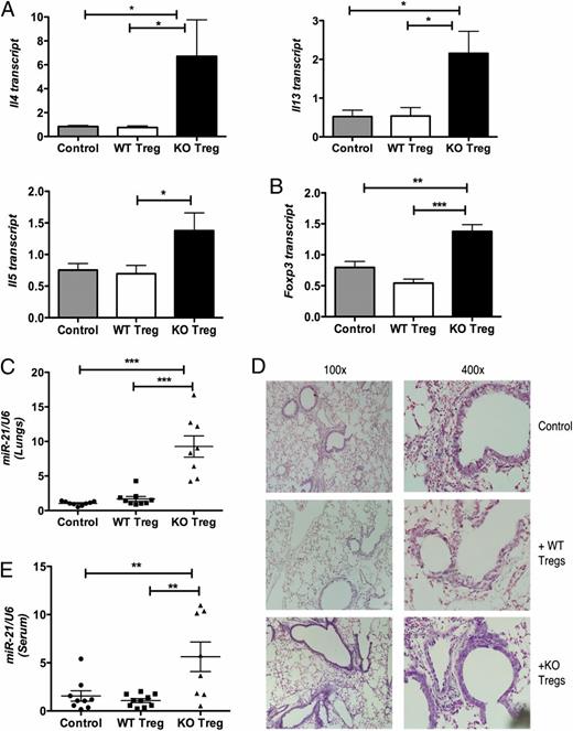 FIGURE 3. Bcl6−/− Tregs exacerbate Th2 responses in allergic airway inflammation associated with a systemic increase in miR-21. (A) QPCR analysis of Th2 cytokine genes (Il4, Il5, Il13) in the total lung RNA of OVA-sensitized and intranasally challenged WT recipient mice (gray bars) or mice immunized i.p. with Bcl6−/− Tregs (black bars) or WT Tregs (white bars). Results are normalized to β2-microglobulin. (B) QPCR analysis of Foxp3 in the total lung RNA for mice treated as in (A), normalized to β2-microglobulin. (C) QPCR analysis of miR-21 in the total lung RNA for the mice treated as in (A), normalized using U6 as control. (D) Expression of miR-21 in the paraffin-embedded lung sections of mice treated as in (A) as determined by LNA-based in situ hybridization. Sections are representative of hybridization results from at least three different experiments. Original magnification ×100 (left) and ×400 (right). (E) QPCR analysis of miR-21 in the sera of mice treated as in (A), normalized using U6 as control. Error bars represent SEM. *p < 0.05, **p < 0.01, ***p < 0.001, one-way ANOVA.