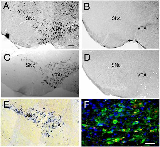 FIGURE 1. Mapping Il13ra1 expression in SNc and VTA. (A) In situ hybridization of Il13ra1 mRNA using antisense RNA probes in representative wt (Il13ra+/Y) mouse brains shows that expression of Il13ra1 is restricted to the SNc and VTA. (B) Representative in situ hybridization of Il13ra1 mRNA sense probe on a brain section from a wt mouse used as a control. (C) Representative in situ hybridization with TH antisense probe used as a marker for DA neurons on a brain section from a wt mouse. (D) In situ hybridization of Il13ra1 mRNA using antisense RNA probes in a representative Il13ra−/Y mouse brain shows no detectable Il13ra1 expression. (E) β-galactosidase assay for the detection of LacZ reporter in a brain from a Il13ra−/Y mouse reveals SNc- and VTA-restricted expression of Il13ra1. (F) The Il13ra1 reporter, LacZ, localizes to DA neurons in the SNc of Il13ra−/Y mice. Representative confocal microscopy images shown were obtained by immunohistochemistry: TH, green; LacZ, red; merge, nuclei stained with DAPI, blue. Scale bars, 200 μm in (A)–(E), 50 μm in (F).