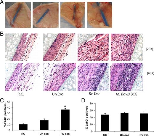 FIGURE 8. Macrophages treated with Rv exosomes can induce cell recruitment in vivo. (A) BMMs stimulated with exosomes, infected with M. bovis BCG, or left untreated were gently removed from plates and added into the lumen of PVDF hollow fibers, which were sealed at both ends. The fibers were then implanted s.c. into SKHI mice and recovered after 16 d. (B) The fibers were fixed in 10% formalin solution, and perifiber tissue was stained with H&E. Original magnifications ×20 and ×40. Results are representative of three independent experiments, each with four mice per group. In a separate group of four mice, cells were removed from the fibers and stained for macrophages and neutrophils, using FITC-conjugated F4/80 (C) and PE-conjugated Ly6G (D), respectively, and analyzed by flow cytometry. Results are the mean of three separate experiments + SD. *Indicates statistical difference when compared with untreated cells/RCs. p ≤ 0.05.