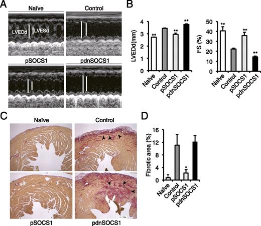 FIGURE 3. SOCS1 DNA administration prevents progression to heart failure. (A and B) Echocardiography was performed on naive and immunized mice on day 35. (A) Representative M-mode echocardiograms. Bars indicate LVESd and LVEDd. Bar graphs (B) represent LVEDd and percentage of FS from the indicated animals (n = 9 mice/group). The percentage FS was calculated according to the following formula: FS (%) = (LVEDd − LVESd)/LVEDd. (C and D) Heart tissue sections were stained with Sirius Red and analyzed for fibrosis at day 35. Representative Sirius Red-stained sections of hearts. Scale bar, 50 μm. (C) Arrowheads indicate fibrotic area. (D) The degree of fibrosis was calculated as the percentage of the fibrotic area in relation to the total heart area (n = 5 mice/group). Data are representative of at least two independent experiments. Error bars represent means ± SEM. *p < 0.05, **p < 0.01 compared with control.