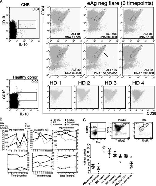 FIGURE 6. Ex vivo characterization of IL-10–producing B cells. (A) Dot plots show the phenotypic characteristics of IL-10–producing B cells (unstimulated, ex vivo) over multiple time points in an HBeAg− patient undergoing a flare (upper and middle panels) or in four healthy donors (HD1-4; lower panels). Black dots represent CD19+IL-10+ B cells overlaid on top of gray dots (CD19+IL-10− B cells). (B) CD19+CD24hiCD38hi (□), CD19+CD24intCD38int (▲), CD19+CD24hiCD38− (X), and total B cell (▪) frequencies are shown in temporal correlation with HBV DNA (; IU/ml) and ALT (◆, IU/l) for two patients undergoing flares of liver inflammation and one HBeAg+ high-level carrier with stable disease. (C) Representative dot plots comparing the frequency of B cell subsets between intrahepatic lymphocytes obtained from biopsy specimens and paired peripheral blood in a patient with CHB (upper panels). Summary data comparing the frequency of intrahepatic versus peripheral B cells subsets in five patients with CHB (lower panel).