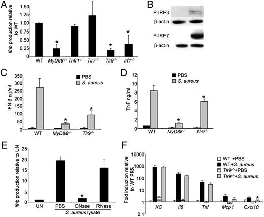 FIGURE 4. TLR9 is the receptor for S. aureus DNA-induced type I IFN signaling. (A) BMDCs from WT and knockout mice were cultured with S. aureus for 2 h, and levels of Ifnb were detected using qRT-PCR. Data are from two independent experiments (n = 6). (B) Phosphorylation of IRF3 and IRF7 was detected using immunoblots from WT BMDCs stimulated with S. aureus USA300 for 2 h. β-Actin was used as a loading control. (C and D) BMDCs were incubated with S. aureus USA300 for 20 h and supernatants collected for (C) IFN-β and (D) TNF ELISA. (E) BMDCs were incubated with S. aureus lysates treated with DNase and RNase, and levels of Ifnb were quantitated with qRT-PCR. Shown is a representative of two independent experiments (n = 3). (F) BMDCs from WT and Tlr9−/− mice were stimulated with S. aureus and transcript levels of proinflammatory cytokines measured by qRT-PCR. Shown is a representative of two independent experiments (n = 3). *p < 0.05. UN, Unstimulated.