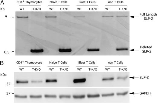FIGURE 1. Generation of SLP-2 T-K/O mice. (A) Genomic DNA was extracted from control and SLP-2 T-K/O CD4+ thymocytes, naive, and blast T cells and non-T cells, and genomic SLP-2 deletion was analyzed by PCR using primers flanking the entire SLP-2 gene. (B) Whole-cell lysates from CD4+ thymocytes, naive, and blast T cells and non-T cells were sequentially immunoblotted for SLP-2 and GAPDH (as a loading control). CD4+ thymocytes were isolated from single-cell suspension of control (WT) and SLP-2 T-K/O thymocytes; splenocyte single-cell suspensions were separated into T cell and non-T cell fractions. Untreated T cells are referred to as naive T cells, whereas T cells stimulated for 72 h with ionomycin and PMA are referred to as blast T cells. Data are representative of three independent experiments using multiple mice with material from a representative mouse per group ran per lane.
