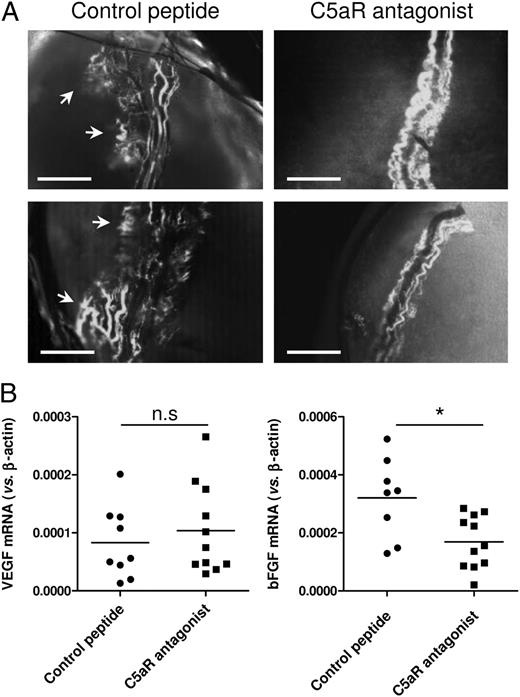 FIGURE 5. Effect of C5a on angiogenesis. (A) Matrigel plugs containing 3LL and 500 ng/ml of the C5aR antagonist or the control peptide were implanted s.c. in the flanks of C57BL mice. Peptides were also injected s.c. (at 1 mg/kg of body weight) 24 h before and after implantation of plugs. Six days later, FITC-labeled dextran was injected i.v., and plugs were extracted and fixed. Visualization of vessels was performed in a Zeiss Axiovert confocal microscope at original magnification ×2.5. Representative photographs of each group are shown. Arrows in the control images point to new vessels formed from the preexisting vasculature. Scale bars, 1 mm. (B) Expression of angiogenic factors in 3LL tumors. Total mRNA was extracted from tumors of mice treated with the control peptide or the C5aR antagonist. mRNA levels of VEGF and bFGF were determined by real-time PCR and expressed as relative to the β-actin mRNA in each tumor. Individual results per animal and mean per group are shown. *p < 0.05.