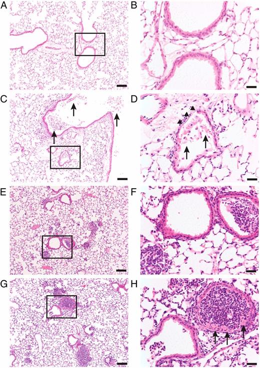 NADPH Oxidase and Nrf2 Regulate Gastric AspirationInduced Inflammation