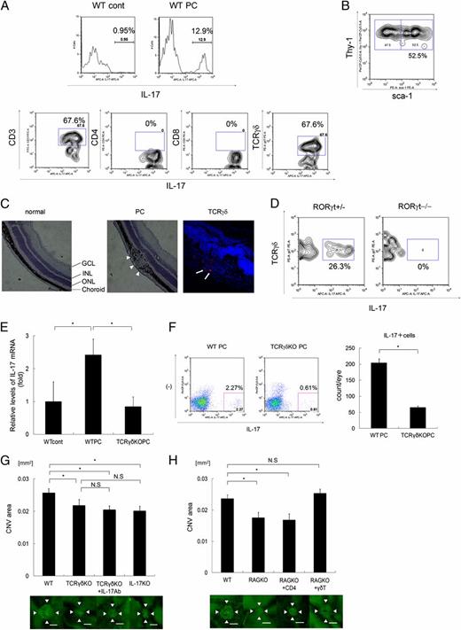 FIGURE 2. The source of IL-17 in the laser-treated eye. (A) Ocular-infiltrating cells were analyzed 4 d after laser treatment. The production of IL-17A in cells was examined by intracellular staining. WT laser-treated eye samples gated for CD45+ cells (upper panels). Samples gated for IL-17A+ cells (lower panels). One representative experiment of three independent experiments is shown. (B) The IL-17A+ cell population in TCRγδ KO mice was analyzed for Thy-1 and Sca-1 expression levels by flow cytometry. (C) Immunohistochemical analysis of retina and RPE/choroid sections on day 4 after laser treatment. H&E staining of the retina and RPE/choroid sections of control and laser-treated mice (left and middle panel, respectively). The retina and RPE/choroid sections were stained with anti-TCRγδ (red) (arrow in right panel). Representative images are shown. Arrowheads denote laser photocoagulated site. Original magnification ×10. (D) Intracellular staining data for IL-17A in laser-treated Rorγt+/gfp mice and Rorγtgfp/gfp mice on day 4 after laser treatment. The panels show the results of gating for TCRγδ+ cells in laser-treated eye samples from each mouse. (E) Total RNA was extracted from the eyes of WT mice and TCRγδ KO mice on day 4 after laser treatment (n = 3). Il17a mRNA levels were normalized to HPRT levels in each sample. *p < 0.01. (F) Intracellular staining data on IL-17A in laser-treated WT mice and TCRγδ KO mice on day 4 after laser treatment (n = 2). The bar graph represents the fraction of the IL-17A+ cell populations. The experiments were repeated three times with similar results. Data are mean ± SE. *p < 0.01. (G) On day 7 after laser treatment, the sizes of CNV areas were evaluated and compared among WT mice, IL-17 KO mice, TCRγδ KO mice, and TCRγδ KO mice with Ab to IL-17 (10 ng/μl; 2 μl) inoculation into the vitreous cavities immediately after laser treatment (n = 10–15). Data are mean ± SE. The experiment was repeated three times with similar results. Arrowheads indicate stained CNV tissues. Scale bars, 100μm. *p < 0.01. (H) A total of 3 × 105 CD3+CD4−TCRγδ+ cells from WT mice or 1 × 106 CD3+CD4+TCRγδ− cells from WT mice, purified by means of flow cytometry, were injected i.v. into Rag2 KO mice. At 4 d after cell transfer, the mice were subjected to laser treatment. On day 7 after laser treatment, eyes were enucleated for evaluation of CNV. Arrowheads indicate stained CNV tissues. Scale bars, 100μm. *p < 0.01. GCL, Ganglion cell layer; INL, inner nuclear layer; ONL, outer nuclear layer.