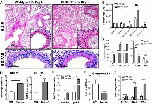 FIGURE 1. Beclin-1+/− mice show increased pulmonary immune infiltration and pathology upon RSV infection. (A) Lung sections from RSV-infected Beclin-1+/− mice or WT littermate controls 8 d postinfection, stained with either H&E (upper panels) or hematoxylin and PAS (H & PAS, lower panels). Arrow indicates apoptotic cell debris within airway mucus plug. (B) Total numbers of lineage-positive immune cells obtained from collagenase-digested lungs of Beclin-1+/− or WT mice 8 d post-RSV infection. (C) LDLNs of Beclin+/− or WT mice, 8 d post-RSV infection, were dissociated into a single-cell suspension and restimulated in culture with RSV. Cytokine concentrations in culture supernatants were assayed using a Bio-Plex system. Lung mRNA expression of CCL20 and CCL11/eotaxin 6 d post-RSV infection (D) and the mucus-associated genes muc5ac and gob5 8 d postinfection (E) were obtained using qPCR and compared with naive controls. (F) Percentage of total lung CD8α+ T cells expressing granzyme B by intracellular staining and flow cytometry, obtained from collagenase-digested lungs 8 d post-RSV infection. (G) Lung mRNA expression values of RSV-G, RSV-F, and RSV-N transcript were obtained by qPCR 8 d postinfection. Fold change was calculated relative to WT, RSV-infected lungs. Data are representative of three independent experiments, with four to six mice/group. Error bars represent SEM. *p < 0.05, **p < 0.01, ***p < 0.001.