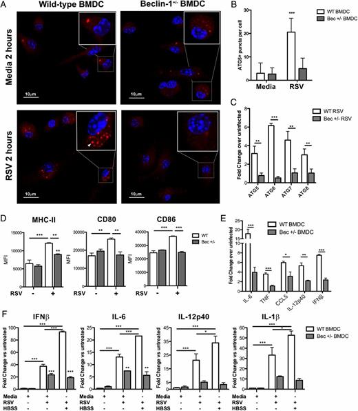 FIGURE 4. Altered autophagosome formation, autophagy-dependent innate cytokine production, and maturation in response to RSV infection by Beclin-1+/− DCs. Autophagosome formation by Beclin-1+/− or WT BMDCs 2 h post-RSV infection (1:1 MOI) was assessed by punctate ATG5 staining and confocal microscopy (A); arrow indicates ATG5+ autophagosome, data are quantified in (B). (C) Autophagy gene expression by Beclin-1+/− or WT BMDCs was assessed 24 h post-RSV infection. (D) Surface costimulatory marker expression by Beclin-1+/− or WT BMDCs was measured by flow cytometry 24 h post-RSV infection. (E) Innate cytokine production by Beclin-1+/− or WT BMDCs was measured by qPCR 24 h post-RSV infection. (F) Innate cytokine production by Beclin-1+/− or WT BMDCs, incubated in media or HBSS for 2 h and followed by 24 h of RSV infection, was assessed by qPCR. Data are representative of at least two independent experiments, with at least four replicates/group. Error bars represent SEM. *p < 0.05, **p < 0.01, ***p < 0.001.