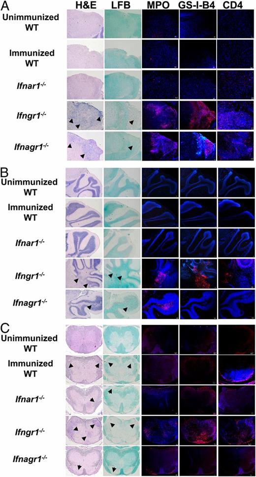 FIGURE 6. IFN-γ signaling determines the distribution of CNS cell infiltration independent of type I IFN signaling. Histology of (A) brain stem, (B) cerebellum, and (C) SC sections from uninduced WT mice and EAE-induced WT, Ifnar1−/−, Ifngr1−/−, and Ifnagr1−/− mice after 20 d of induction. Tissue sections were stained to evaluate cell infiltration (H&E), demyelination (Luxol fast blue, LFB), neutrophil infiltration (myeloperoxidase, MPO), microglia/macrophage activation (GS-IB4), and CD4+ T cell infiltration. Arrows mark areas of cell infiltration or demyelination. Representative sections from two serial sections per mouse from two mice per group are shown.