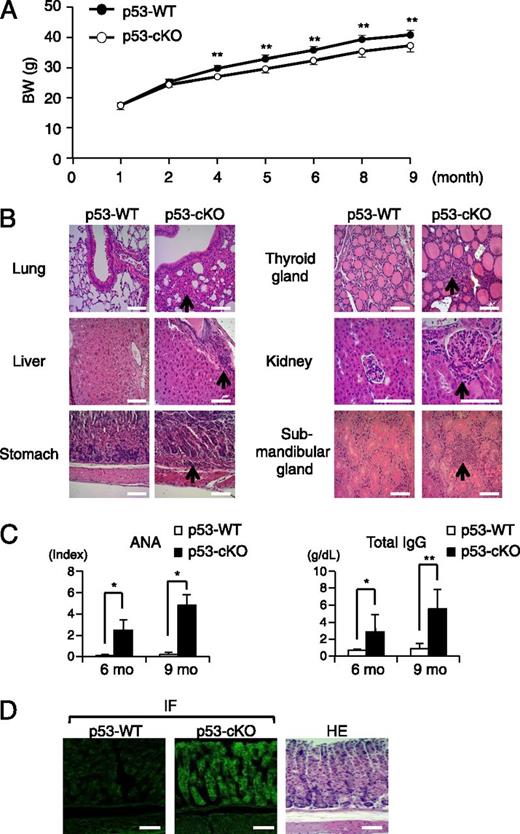 Tumor Suppressor p53 Inhibits Systemic Autoimmune Diseases by Inducing ... Biology Diagrams