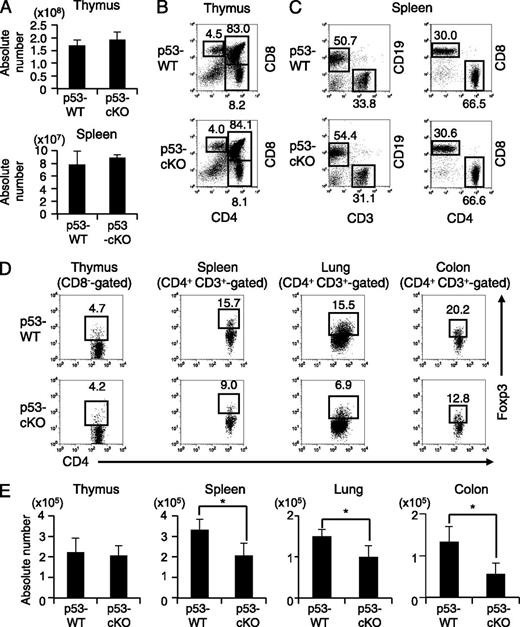 Tumor Suppressor p53 Inhibits Systemic Autoimmune Diseases by Inducing ... Biology Diagrams