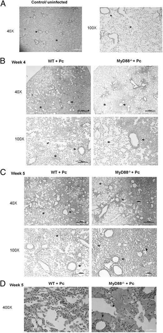 FIGURE 8. MyD88 contributes to lung inflammation early during Pneumocystis infection. CD4+ T cell–depleted C57BL/6 (WT) and MyD88−/− mice were infected with 5e5 freshly isolated Pneumocystis cysts. Lung sections from uninfected control mice (A) or Pneumocystis-infected mice at week 4 (B) or week 5 postinfection (C, D) were stained with H&E. Representative pictures were taken by microscopy under ×40, ×100 (A–C), or ×400 (D) magnification as indicated. Arrows denote peribronchiolar regions in each section, and asterisks denote alveolar regions. In (C) and (D), arrowheads indicate foamy exudates in alveolar spaces.