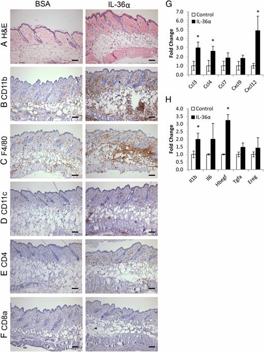 FIGURE 2. IL-36 induces myeloid cell infiltration of skin concomitant with chemokine and growth factor induction. A total of 5 μg murine rIL-36α or BSA was injected intradermally into CD1 mice every other day for 10 d. Back skin was harvested, snap frozen, and processed for RNA and histochemistry. IL-36α treatment led to acanthosis and an increase in eosinophilic dermal collagen (A) and striking infiltration of granulocytes (CD11b) (B), macrophages (F4/80) (C), DC (CD11c) (D), CD4+ cells (E), but not CD8+ cells (F). These changes were accompanied by increases in chemokines (G) and cytokines/growth factors (H). Mean ± SEM (n = 4 mice). Statistical significance indicated by *p < 0.05 (two-tailed t test). Scale bar, 100 μm.