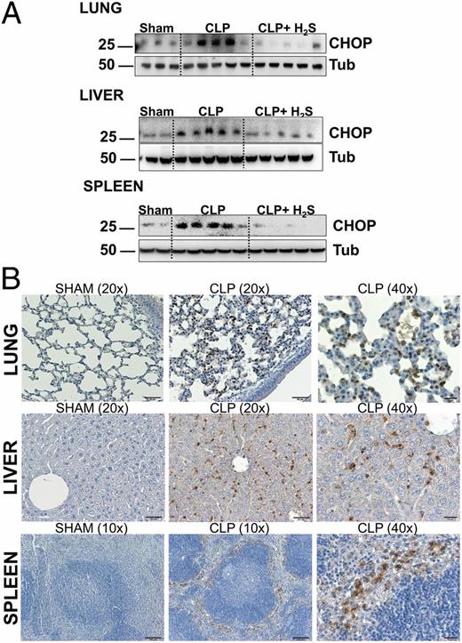 FIGURE 5. H2S decreases CHOP expression in vivo. (A) Spleens, lungs, and livers harvested 18 h after CLP were homogenized and analyzed by Western blot for expression of CHOP. Tubulin (Tub) was used as a loading control. Samples analyzed are from single mice (Sham, n = 2–3; CLP and CLP+H2S, n = 5). Data are a representative of two independent experiments with similar results. (B) Representative immunohistochemistry of CHOP expression in sham and CLP mice. Scale bars, 10× = 100 μm, 20× = 50 μm, and 40× = 20 μm.