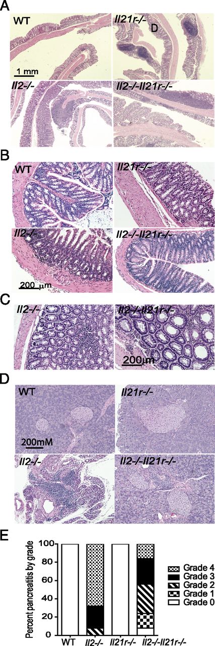 FIGURE 3. Mild colitis and severe pancreatitis in Il2−/− mice is improved in the absence of IL-21R. (A) Representative H&E-stained histological sections of the distal colon from indicated genotypes showing (B) crypt branching and (C) mononuclear cell infiltrate in Il2−/− strains. (D) Representative H&E-stained histological sections of pancreata from indicated genotypes. (E) Pancreatitis grade from histological sections of indicated genotypes. At least 10 sections were assessed throughout the pancreas per mouse. Colon and pancreata samples were obtained from 10- to 14-wk-old mice; n = 10 for WT and Il21r−/− samples and n = 10–15 for Il2−/− and Il2−/−Il21r−/− strains.