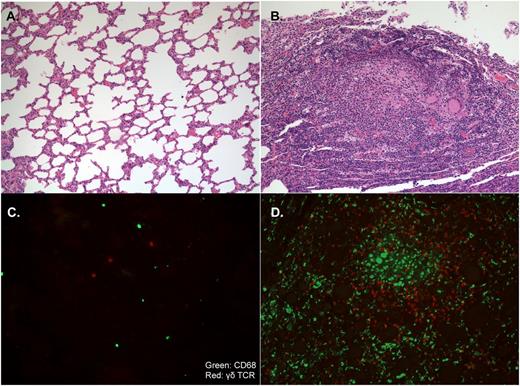 FIGURE 8. γδ T cells accumulate in M. bovis lesions in the lungs of infected cattle. The lungs of uninfected or virulent M. bovis 95-1315– or M. bovis 10-7428–infected animals were analyzed 3.5 mo after aerosol challenge for M. bovis lesion formation. Paraffin-embedded lung sections from uninfected (A) and infected (B) animals were stained with H&E (original magnification ×20). Frozen lung sections from control uninfected (C) and infected (D) animals were stained for immunofluorescence with anti-bovine CD68 (green) and anti-bovine γδ TCR (red), as described in Materials and Methods (original magnification ×20). No significant differences were observed between animals infected with M. bovis 95-1315 or 10-7428. Results are representative of four uninfected animals and nine infected animals.