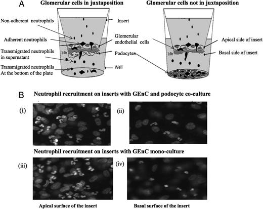 FIGURE 1. Illustration of the coculture system in the transwell. (A) Coculture of GEnCs and podocytes with or without being in juxtaposition. Podocytes and GEnCs on the opposite side of the porous insert formed cocultures in juxtaposition. Cocultures without being in juxtaposition were formed allowing the cell types to communicate through release of soluble mediators. Neutrophil recruitment was assessed to represent all cells that had bound to the GEnCs (i.e., firmly adherent and transmigrated). (B) Fluorescent micrographs showing neutrophil binding to and transmigration through GEnC/podocyte cocultures: (i) Apical surface of transwell insert with neutrophils adherent to GEnCs in coculture, (ii) basal side of transwell insert with transmigrated neutrophils adjacent to podocytes in coculture, (iii) apical surface of transwell insert with neutrophils adherent to GEnCs in monoculture, and (iv) basal side of transwell insert with transmigrated neutrophils in GEnC monocultures. Original magnification ×40.