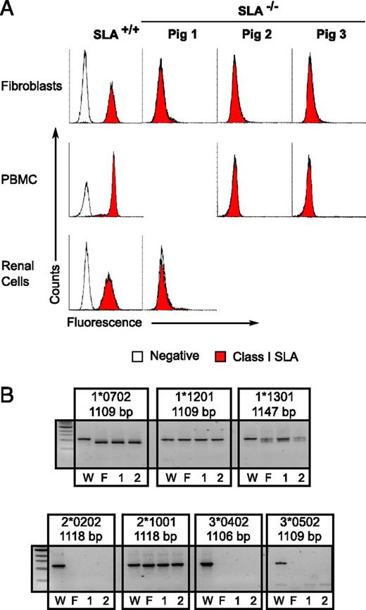 FIGURE 4. Phenotypic and cDNA analyses of class I SLA–deficient piglets. (A) Three piglets, recloned from the SLA− fetal fibroblast cells isolated in Fig. 3, were examined for cell surface expression of class I SLA proteins on the surface of fibroblasts (all three animals), PBMCs (piglets 2 and 3), or cells isolated from the kidney (piglet 1). Corresponding class I SLA+ cells are shown for comparison. Relative binding of class I–specific SLA Abs and an irrelevant isotype control are shown. (B) cDNAs, prepared from fetus 2 and piglets 1 and 2, were subjected to PCR with primers designed to amplify individual alleles of class I SLA. Sample W represents an identical analysis of the untreated parental, SLA-expressing, fibroblasts. The length of the predicted full-length transcript is indicated below each allele name. F represents samples isolated from fetus 2 that was shown to be SLA deficient in Fig. 3. Samples from the SLA negative cloned pigs are indicated by 1 and 2.