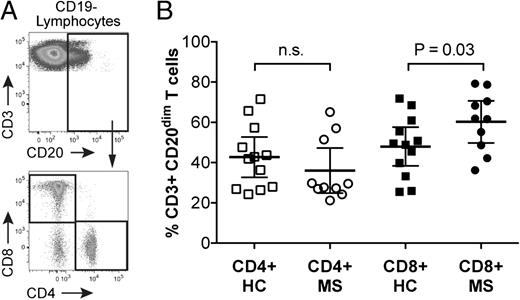 FIGURE 2. In MS, CD8+ T cells are increased among CD3+CD20dim T cells. Shown are CD3+CD20dim T cell gating strategy (A) and scatter plots (B; mean and 95% CI) of CD4+ and CD8+ cells among CD3+CD20dim T cells in UNT MS patients (MS) and HC. Comparisons between MS and HC were made using one-sided t test.