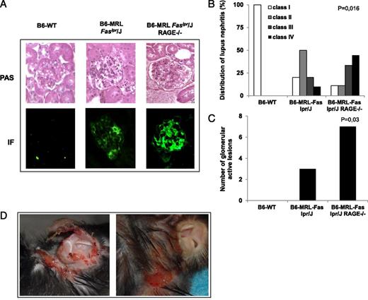 FIGURE 3. RAGE deletion promotes kidney and skin injury in B6-MRL-Fas lpr/J mice. (A) Representative picture of the kidneys showing exacerbated kidney damage in B6-MRL-Fas lpr/J RAGE−/− mice with diffuse mesangial proliferation and intense IgG deposition in the glomeruli. Kidneys were stained with periodic acid Schiff for histologic assessment and with anti-IgG for immunofluorescence (original magnification ×10). (B) Repartition of renal lesions according to the International Society of Nephrology/Renal Pathology Society (ISN/RPS) 2003 classification of lupus nephritis: B6-WT (n = 3), B6-MRL-Fas lpr/J (n = 10), and B6-MRL-Fas lpr/J RAGE−/− (n = 9) age-matched mice. Class I: minimal mesangial lupus nephritis. Class II: mesangial proliferative lupus nephritis. Class III: focal lupus nephritis. Class IV: diffuse lupus nephritis. Statistical significance was assessed using the Kruskall–Wallis test, p = 0.016. (C) Quantification of active lesions defined by presence of proliferating lupus nephritis. Statistical significance was assessed using the Kruskall–Wallis test, p = 0.03. (D) Representative picture of autoimmune skin and ear injury in old B6-MRL-Fas lpr/J RAGE−/− mice.