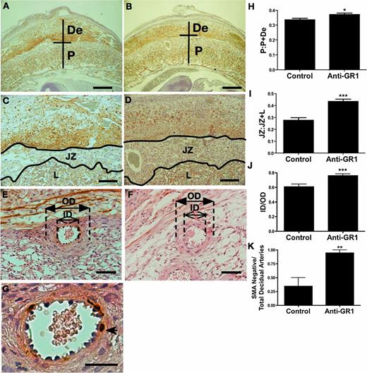 FIGURE 3. Neutrophil depletion improves placental morphology of BPH/5 mice. BPH/5 mice were treated with anti-GR1 Ab to deplete neutrophils or isotype control on E2.5, sacrificed on E12.5, and placental histology was examined. Representative images of intact feto-placental units from isotype control–treated BPH/5 mice (A and C) and anti-GR1–treated BPH/5 mice (B and D) are shown. Neutrophil depletion normalizes the proportional depth of the placental disc (P:P+De) (H) and the fractional area of the junctional zone relative to the placental disc (JZ:JZ+L) (I). Representative images of decidual spiral arteries demonstrating thick walls in the isotype=treated BPH/5 mice (E) and thin arterial walls in the anti-GR1–treated mice (F) (closed arrows indicate outer diameter [OD]; open arrows indicate inner diameter [ID]). (J) Data are summarized as ratios of the inner lumen to outer vessel diameter (ID/OD). Representative images of decidual spiral arteries demonstrating positive staining for SMA in isotype-treated BPH/5 mice (arrowhead) (E and G) and loss of SMA staining in the anti-GR-1–treated mice (F) are shown. (K) Data are summarized as a ratio of remodeled arteries relative to total number of decidual spiral arteries. Data are presented as mean ± SEM. For histologic studies, a minimum of nine feto-placental units were analyzed for each condition (three implantation sites from three separate pregnancies). Scale bars, 500 μm (A and B), 200 μm (C and D), 50 μm (E and F), 25 μm (G). *p < 0.05, **p < 0.01, ***p < 0.001. De, decidua; JZ, junctional zone; L, labyrinth; P, placental disc.
