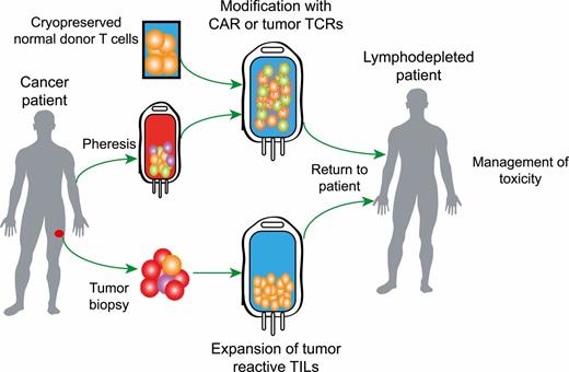 FIGURE 1. Cellular therapy has several pathways to the patient. Normal donor cells can be modified to inactivate their alloreactivity while being armed with antitumor CARs or TCRs, or a patient’s own cells can be modified with antitumor molecules. In the case of solid tumors, biopsy specimens can be used to isolate TILs for expansion. In most cases the patient will require some amount of conditioning before receiving antitumor lymphocyte infusions, and careful management of toxicities emerging from these therapies is also required.