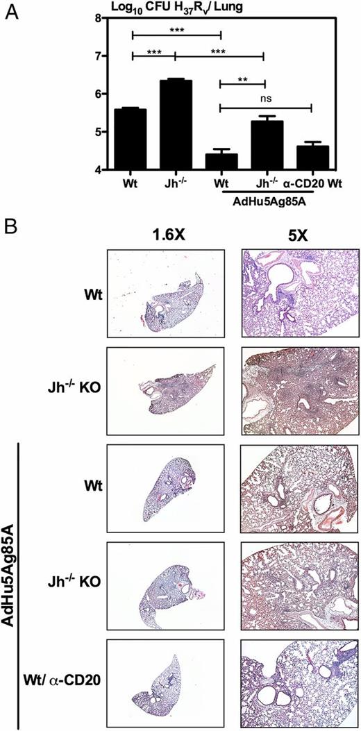 FIGURE 4. Immune protection and histopathological changes in the lungs after i.n. AdHu5Ag85A vaccination in WT, Jh−/− KO, and B cell–depleted mice following pulmonary M. tuberculosis infection. (A) M. tuberculosis burden in the lung of unvaccinated WT and B cell KO (Jh−/−) mice and in AdHu5Ag85A-vaccinated WT, Jh−/− KO, and anti-CD20 B cell–depleted WT mice was assessed at 2 wk after M. tuberculosis H37Rv challenge. Data are expressed as mean ± SEM of five mice per group, representative of two independent experiments. **p ≤ 0.01, ***p ≤ 0.001. (B) Histopathology in the lung of unvaccinated WT and B cell KO (Jh−/−) mice and in AdHu5Ag85A-vaccinated WT, Jh−/− KO, and anti-CD20 B cell–depleted WT mice was assessed at 2 wk after M. tuberculosis H37Rv challenge by H&E staining. The histomicrographs shown are representative of three animals per group.