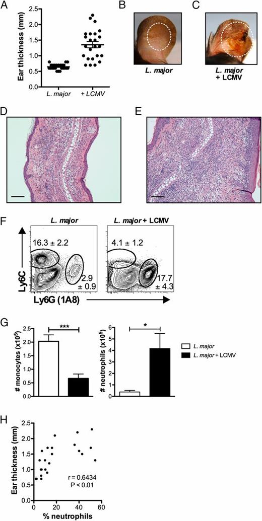 FIGURE 3. Coinfected mice exhibit increased inflammation. (A) Lesion size of coinfected mice at 5 wk. (B) Lesion of mice infected for 5 wk with L. major. (C) Lesion of mice infected for 5 wk with L. major, which were coinfected at 2 wk with LCMV. (D) H&E section of a lesion of mice infected for 5 wk with L. major. (E) H&E section of a lesion of mice infected for 5 wk with L. major that were coinfected at 2 wk with LCMV. Scale bars, 100 μM. (F) At 5 wk after L. major infection, infected skin was harvested, digested, and stained with Abs for myeloid cells. Myeloid cells were pregated on live, CD45+, CD11b+ before the gates shown for monocytes and neutrophils. Representative plots are shown with the mean percentage of total CD45+ cells ± SEM. (G) The number of neutrophils and monocytes is shown. (H) Correlation between lesion size and neutrophils. Data are representative of four independent experiments (n = 4–5 mice/group). Percentages are shown as mean ± SEM. Error bars represent SEM. *p < 0.05, ***p < 0.0001.