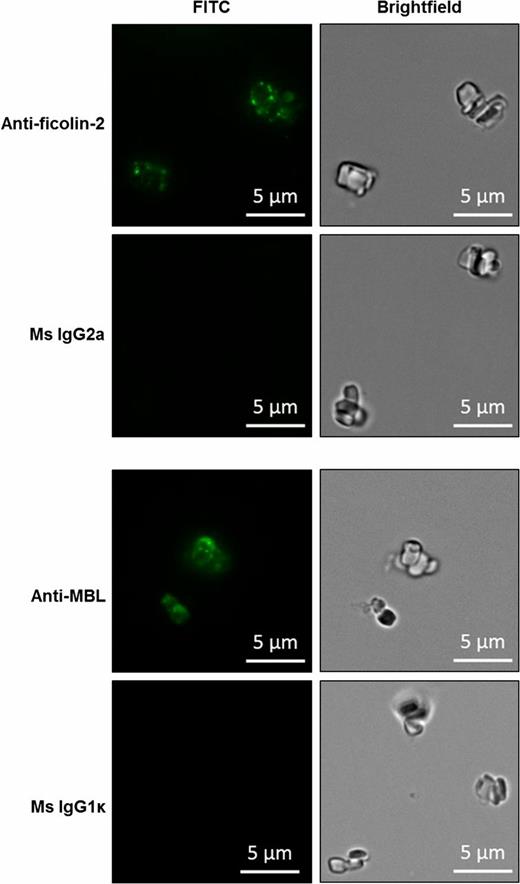 FIGURE 2. Binding of recombinant ficolin-2 and MBL to CC. Binding of ficolin-2 (8 μg/ml) and MBL (20 μg/ml) to CC assessed by fluorescence microscopy. Imaging conditions were kept constant when acquiring images to be compared. Results are representative of three independent experiments.