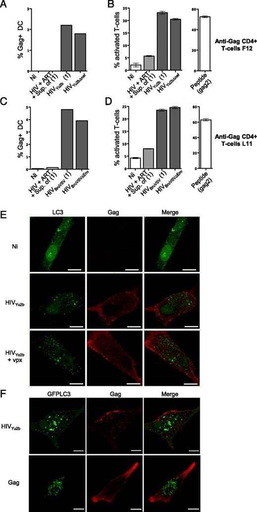 FIGURE 5. HIV Nef and Env do not impact endogenous presentation of HIV Gag Ag. DC were generated from HLA-DRβ1*04+ PBMC and infected with HIVYu2b, HIVYu2b∆Nef (A and B), or HIVYu2b∆Env (C and D) with and without ART. At day 5 p.i., DC were collected and the percentage of infected Gag+ cells was evaluated (A and C). Infected DC were then used to stimulate F12 or L11. T cell activation was monitored using ICCS (B and D). Results are presented as the percentage of activated cells producing at least one cytokine/chemokine. Uninfected DC (Ni) and DC pulsed with the cognate peptide (gag2, 0.5 μg/ml) were used as negative and positive controls, respectively. DC infected in the presence of ART (HIV + ART) were loaded with the supernatant of infected cells [Sup. of (1)] and used as control. (E) Gag does not colocalize with autophagosomes in HIV-infected DC. DC were infected with HIVYu2b or HIVYu2b plus SIV-Vpx. Gag colocalization with LC3 was monitored 4 d p.i. using anti-Gag and anti-LC3 Abs and IF. Scale bars, 10 μm. (F) To facilitate the detection of autophagosomes, DC were transduced with GFP-LC3 and infected with HIVYu2b or cotransduced with a vector encoding HIV Gag protein in the absence of other viral proteins. Gag colocalization with GFP-LC3 was monitored, 4 d p.i. or transduction, using anti-Gag Ab and IF. All results are representative of at least three independent experiments using DC from different donors. Scale bars, 10 μm. HIV (1), HIV-infected cells; Ni, noninfected cells; Sup. of (1), supernatant of HIV-infected cells.