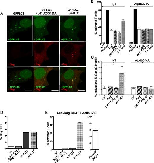 FIGURE 7. Autophagic degradation is required to enhance T cell activation and reveals additional MHC-II–restricted endogenous epitopes. (A) HeLa-CIITA cells were transduced with GFPLC3 or cotransduced with p41LC3 and p41LC3G120A and colocalization analyzed by IF and confocal imaging. Scale bars, 10 μm. (B) A representative experiment using HeLa-CIITA cells and Atg4BC74A+ Hela-CIITA cells transfected with DNA plasmids encoding either HIVYu2b (HIV), HIV Gag protein (Gag), p41LC3G120A, or p41LC3. At day 3 after transfection, cells were collected and the percentage of Gag+ cells was evaluated using ICS (whatever the treatments, transfected cells exhibited similar levels of Gag+ cells; not shown). The cells were then used to stimulate F12 and T cell activation was monitored using ICCS as in Supplemental Fig. 1. Results are presented as the percentage of activated cells producing at least one cytokine/chemokine. The experiment was performed in duplicate. (C) Mean (±SD) of three independent experiments performed in duplicate presented as the percentage of activated cells divided by the percentage of transfected (Gag+) cells. Enhancement of T cell activation with p41LC3 (p < 0.038) was statistically significant (Wilcoxon rank sum test). UT, mock-transfected. (D and E) HLA-DRβ1*01+ DC were either transduced with p41LC3 or infected with HIVYu2b with and without ART. Five days later, the percentage of Gag+ cells was monitored by ICS (D) and DC used to stimulate IV-9 (E). T cell activation was monitored using ICCS. Results are presented as percentage of activated cells producing at least one cytokine/chemokine and are the mean ± SD of duplicates. Noninfected DC (Ni) and DC pulsed with gag1 (0.5 μg/ml) were used as negative and positive controls, respectively. Uninfected DC pulsed overnight, in the presence of ART, with the supernatant of HIV-infected cells [Ni + Sup. of (1)] and DC infected in the presence of ART (HIV + ART 5 d) were pooled and used as a control. The results are representative of at least three independent experiments using DC from various donors. HIV (1), HIV-infected cells; Ni, noninfected or untransduced cells; Sup. of (1), supernatant of HIV-infected cells.