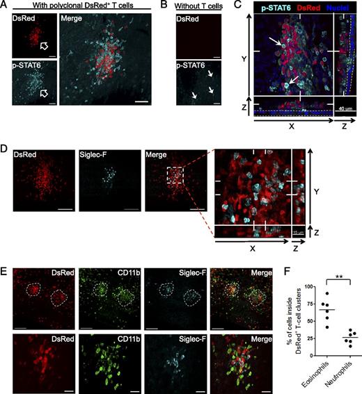 FIGURE 7. STAT6 phosphorylation and myeloid effector cell recruitment in the tracheal mucosa are associated with CD4+ T cell clusters. HDM-primed polyclonal CD4+ T cells, isolated from the bronchial lymph node of CAG-DsRed mice, were adoptively transferred into TCRα−/− mice on day −7. At day 0, recipients received HDM/CT o.ph., and perfusion-fixed tracheas were collected at different time points for whole-mount confocal analysis. (A–C) Analysis of p-STAT6 distribution at day 3. (A) Colocalization of a p-STAT6+ cell cluster with a cluster of DsRed+ polyclonal effector T cells (arrows indicate the clusters). (B) Lack of bright p-STAT6+ cells in mice without transferred T cells (arrows indicate a few dim p-STAT6+ cells). Images in (A) and (B) were acquired using the same laser intensity and detector settings (scale bars, 50 μm). (C) XY, XZ, and YZ representations of a subepithelial effector cluster (slice positions are indicated by tick marks). The tracheal epithelium is shown between the dashed lines. Arrows show bright p-STAT6+ cells. DsRed+ p-STAT6+ cells were excluded from the final images. (D–F) Mice were challenged on day 7, and perfusion-fixed tracheas were collected for whole-mount confocal analysis of eosinophil and neutrophil accumulation on day 9. (D) Localization of Siglec-F+ eosinophils in a DsRed+ CD4+ effector cluster. Boxed region is enlarged (far right panel) and shown as XY, XZ, and YZ representations (a range of slices is shown, as indicated by tick marks). Scale bars, 100 μm. (E) Lower-magnification images of two DsRed+ CD4+ effector clusters (dashed lines) showing the partial or complete colocalization of CD11b+ neutrophils and Siglec-F+ eosinophils, respectively (upper panels; scale bars, 100 μm). Higher-magnification images of a DsRed+ CD4+ effector cluster showing eosinophils and neutrophils within the clusters (lower panels; scale bars, 20 μm). (F) Quantitation of eosinophil or neutrophil localization within T cell clusters. Six clusters (n = 6) were analyzed in three tracheas. All images are representative of at least two independent experiments. **p < 0.01, Mann–Whitney U test.