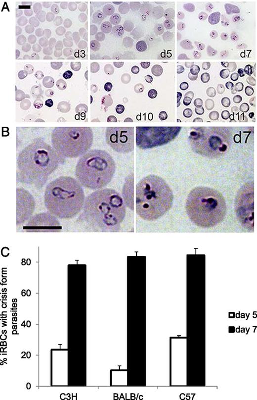 FIGURE 2. Morphology of parasites and RBCs throughout infection. Reticulocytosis and parasite crisis forms inside infected erythrocytes correlates with parasite clearance. (A) Giemsa-stained blood smears from BALB/cJ mice during B. microti infection during parasite replication (days 3 and 5), onset of parasite clearance (day 7), and resolution of infection (days 10 and 11). (B) Morphology of parasites in infected RBC (iRBCs) on day 5 compared with day 7 postinfection. The morphology of intraerythrocyte parasites changes from ring forms on day 5 postinfection to crisis forms by day 7 postinfection. (C) Percentage of infected erythrocytes containing crisis forms of the parasite on day 5 or 7 postinfection of C3H/HeJ, BALB/cJ, and C57BL/6J mice. The mean and SE from four counts of 100 infected erythrocytes per mouse obtained from Giemsa-stained blood smears are shown. n = 5 mice per group. Scale bars, 5 μm.