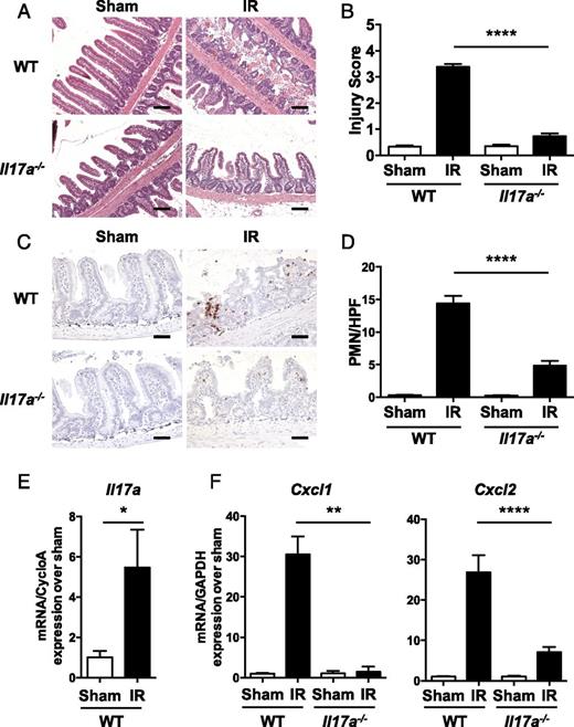FIGURE 1. IR injury is attenuated in Il17a−/− mice. Representative H&E-stained sections (A), injury scores (B), representative immunohistochemical staining for Gr1 (C), quantitation of infiltrating Gr1+ cells per HPF (D), and qRT-PCR analysis of Il17a (E) and Cxcl1 and Cxcl2 (F) expression in Il17a−/− mice and WT controls subjected to intestinal IR injury or sham operation. Results are derived from three independent experiments, each with three or four mice per group. Data in bar graphs are mean + SEM. Scale bars, 100 μM (A), 50 μM (C). *p < 0.05, **p < 0.01, ****p < 0.0001.