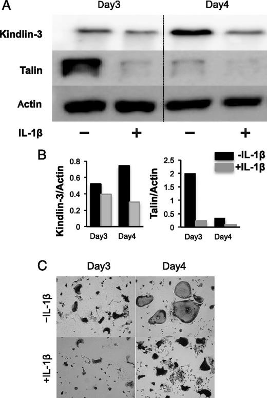 FIGURE 8. Marked suppression of Kindlin-3 and Talin-1 expression in IL-1β–induced osteoclasts. (A) Western blot of Kindlin-3 and Talin-1: proteins recovered from osteoclasts cultured (day 3 and day 4) in the presence or absence of IL-1β (± IL-1β) were subjected to the electrophoresis using a 7.5% SDS-PAGE gel followed by Western blotting to confirm expression of Kindlin-3 and Talin-1. (B) Densitometric analysis of the data in (A). (C) Morphology of normal osteoclasts (−IL-1β) and PAOC (+IL-1β). After culture, cells were fixed and stained for TRAP.