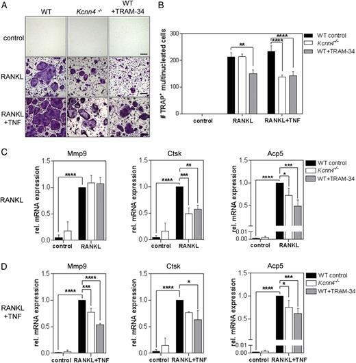 FIGURE 2. RANKL-stimulated BMMs from Kcnn4−/− mice or treated with TRAM-34 in combination with TNF show decreased osteoclast formation correlated with decreased expression of osteoclast-specific genes. (A) Representative images of cytochemical TRAP staining of murine WT, Kcnn4−/−, and WT+TRAM-34 (10 μM) BMMs cultured in indicated condition (scale bar, 100 μm). (B) Numbers of multinucleated TRAP+ cells (MNCs) (purple) (≥3 nuclei) in these cultures (n = 4); (C) qPCR analysis showing normalized mRNA expression of osteoclast-specific genes Mmp9, Ctsk, Acp5 in RANKL; and (D) RANKL+TNF stimulated BMMs. One-way ANOVA followed by multiple comparison test was performed for all experiments (n = 4); shown are mean ± SEM. *p < 0.05, **p < 0.01, ***p < 0.001, ****p < 0.0001.