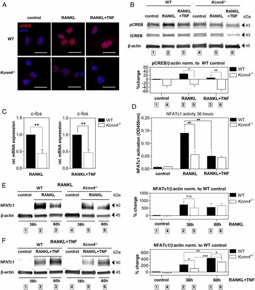 FIGURE 4. Kcnn4−/− BMMs show decreased pCREB and expression of c-fos followed by reduced amplification and activity of NFATc1. (A) IF staining of pCREB (red) and DAPI (blue) of BMMs obtained from WT and Kcnn4−/− mice stimulated with RANKL or RANKL+TNF for 36 h visualized with confocal microscopy (n = 2, scale bar, 15 μm). (B) Western blot analysis of pCREB versus total CREB (tCREB) and β-actin; top: representative blot; bottom: densitometric analysis. One-way ANOVA with post hoc multiple comparison test was performed (n = 2, p = 0.004). (C) qPCR analysis showing normalized c-fos mRNA expression of WT control and Kcnn4−/− BMMs cultivated in indicated conditions for 36 h. Student unpaired t test was performed (n = 4). (D) Transcription factor binding assays showing transcriptionally active NFATc1 protein obtained from nuclear lysates of 36 h stimulated WT and Kcnn4−/− BMMs in indicated conditions. One-way ANOVA with post hoc multiple comparison test was performed (n = 3, p = 0.0003). (E and F) Western blot analysis of NFATc1 protein expression obtained from whole cell lysates of WT and Kcnn4−/− BMMs stimulated for given time periods in indicated conditions; left: representative blots, right: densitometry analysis. One-way ANOVA with post hoc multiple comparison test was performed. (E) n = 3, p = 0.0164; (F) n = 3, p < 0.0001. Shown are mean ± SEM. *p < 0.05, **p < 0.01, ***p < 0.001.
