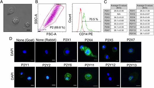 FIGURE 1. Characterizing GM-MDM cells and purinergic signaling in GM-MDM cells. (A) Bright field image to study morphology of GM-MDM cells resembling classical “fried-egg” characteristics. Scale bar, 10 μm. (B) Flow cytometer analysis: forward (FSC) versus side (SSC) scatter plot with P2 population indicating MDM population (left panel) and histogram to quantify CD14+ GM-MDM cells (red: IgG isotype control, green: CD14-PE; right panel). (C) Level of mRNA expression of P2X and P2Y receptor genes as quantified by qRT-PCR (n = 5 donors). mRNA transcript found above crossing time 35 is considered absent. (D) Distribution and expression of intracellular P2X and P2Y receptor proteins in GM-MDM cells as visualized under confocal microscopy. Secondary only control with either goat Alexa Fluor 488 or rabbit Alexa Fluor 488 are included on the left. Scale bar, 10 μm. Images shown in (A), (B), and (D) are representative of three donors.