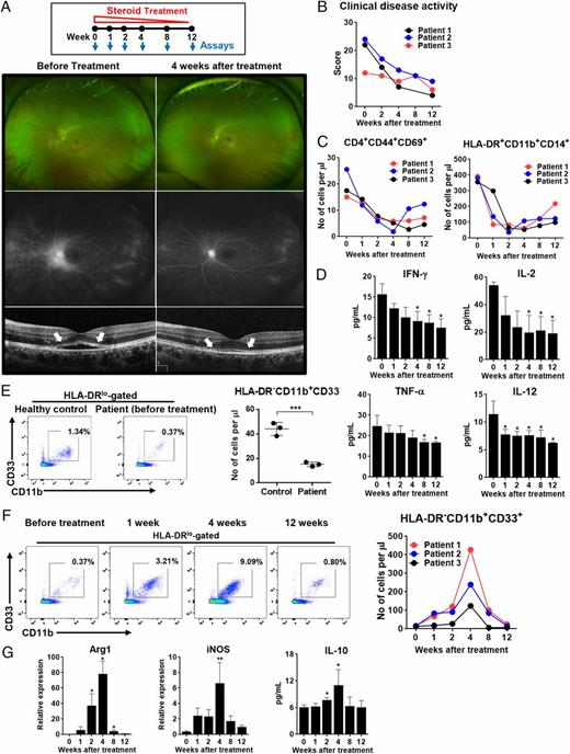 FIGURE 1. HLA-DR−CD11b+CD33+CD14+ monocytic MDSCs were increased in the peripheral blood of autoimmune uveoretinitis patients during the disease resolution. (A) Schema of assays. Fundus photography, FA (late phase), and macular optical coherence tomography showed optic disc hyperemia with leakage and margin blurring, flame-shaped intraretinal hemorrhage, staining and leakage along peripheral retinal vessels, and accumulation of subretinal fluid indicating macular edema (arrows) before treatment (left). After 4 wk of treatment, disc hyperemia disappeared, retinal hemorrhage was absorbed, and macular edema (arrows) almost disappeared, all of which indicated the clinical remission of inflammation (right). (B) Time course of clinical disease score assigned by FA findings. (C) Quantitative flow cytometry results for activated T cells (CD4+CD44+CD69+ cells) and proinflammatory monocytes (HLA-DR+CD11b+CD14+ cells). (D) Multiplex cytokine assay for IFN-γ, IL-2, TNF-α, and IL-12 in the plasma. (E) Representative and quantitative flow cytometry results for expression of CD11b and CD33 after gating on HLA-DR− cells in PBMCs of autoimmune uveoretinitis patients at disease presentation (before treatment), compared with healthy controls. Dot indicates an individual patient. (F) Representative and quantitative flow cytometric analysis for expression of CD11b and CD33 after gating on HLA-DR− cells in PBMCs of autoimmune uveitis patients over 12 wk of treatment. Most HLA-DR−CD11b+CD33+ cells were positively stained with CD14. (G) Real-time RT-PCR assay for Arg1 and iNOS in PBMCs and ELISA for IL-10 in plasma. Shown are the relative values of mRNA levels to the levels in healthy control subjects. Data are presented as mean + SD. *p < 0.05, **p < 0.01, ***p < 0.001.