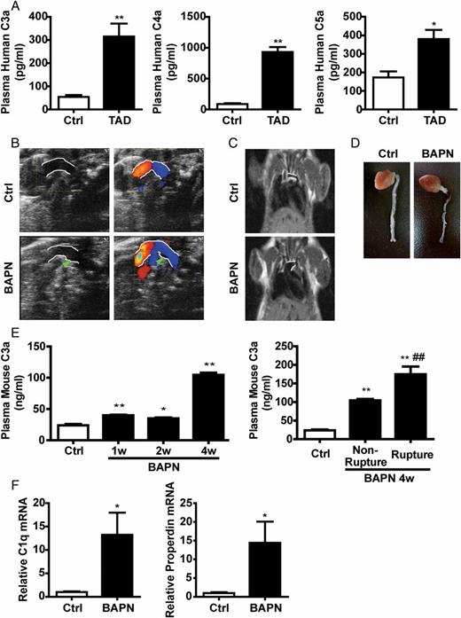 FIGURE 1. The complement system is activated in patients with TAD and in BAPN-treated mice. (A) Plasma C3a, C4a, and C5a levels in patients with TAD and healthy controls (Ctrl) were assayed using a BD Cytometric Bead Array (BBA) Human Anaphylatoxin Kit. Data represent the mean ± SEM; nCtrl = 7, nTAD = 12. C57BL/6 mice were administered BAPN for 4 wk. (B) The direction of flow in the aortas of these mice was detected by color Doppler ultrasonography (white lines indicate the aortic walls, and the green arrowhead denotes an area without flow). (C) MRI images of aortas (white lines indicate aortic walls). (D) Representative macroscopic images show blood clot formation in a dissected thoracic aorta induced by 4 wk of BAPN treatment. (E) Plasma levels of the anaphylatoxin C3a in mice treated with BAPN for 1 wk (BAPN 1w), 2 wk (BAPN 2w), and 4 wk (BAPN 4w) were assayed by ELISA. Data represent the mean ± SEM; nCtrl = 10, nBAPN 1w = 10, nBAPN 2w = 7, nBAPN 4w = 13, nNonrupture = 9, nRupture = 7. (F) C1q and properdin mRNA expression in aortas was assessed by qPCR and expressed as fold induction compared with controls after being normalized to GAPDH. Data represent the mean ± SEM; n = 6. *p < 0.05, **p < 0.01 versus Ctrl. ##p < 0.01 versus nonrupture.