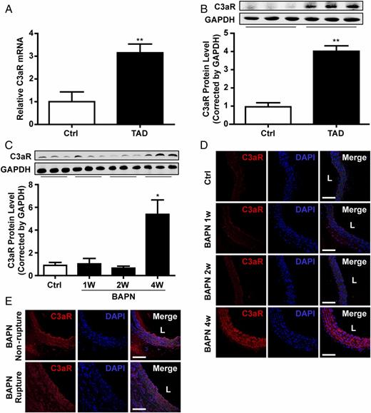 FIGURE 2. C3aR expression is increased in aortas in patients with TAD and in BAPN-treated mice. (A) C3aR mRNA levels in human dissected tissues were assessed by qPCR and expressed as fold induction compared with controls after being normalized to GAPDH. Data represent the mean ± SEM; n = 5. (B) C3aR protein expression levels in human dissected aortas were detected and presented as fold induction compared with controls after being normalized to GAPDH. Data represent the mean ± SEM; n = 5. (C) C3aR protein expression levels in aortas of mice treated with BAPN for different time points were assessed and presented as fold induction compared with controls after being normalized to GAPDH. Data represent the mean ± SEM; n = 6. C3aR expression in aortas from BAPN-treated mice (D) and in ruptured and nonruptured aortas (E) was examined with a specific Ab and an Alexa Fluor 555–labeled secondary Ab. Nuclei were stained with DAPI; n = 6. Scale bars, 100 μm. *p < 0.05, **p < 0.01 versus control (Ctrl). L, aortic lumen.