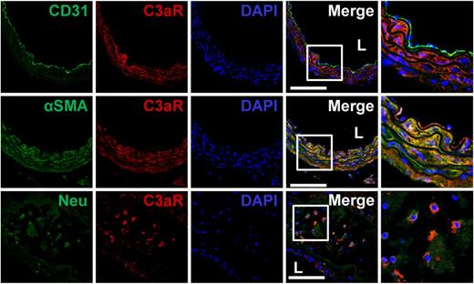 FIGURE 3. Increased C3aR protein expression in SMCs of aortas from BAPN-treated mice. Cellular localization of C3aR in aortas of mice treated with BAPN for 4 wk was detected by costaining of C3aR with CD31, αSMA, or neutrophil with primary Abs, followed by Alexa Fluor 488–labeled or Alexa Fluor 555–labeled secondary Ab. Nuclei were stained with DAPI; n = 6. Scale bars, 100 μm. L, aortic lumen.