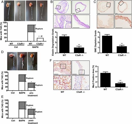 FIGURE 4. KO or pharmacological inhibition of C3aR protects against development of BAPN-induced TAD. Three-week-old WT and C3aR-KO mice were administered BAPN or vehicle in the drinking water for 4 wk. (A) Representative macroscopic views showing that depletion of C3aR prevents the formation and rupture of BAPN-induced TAD. nWT Ctrl = 6, nC3aR−/− Ctrl = 6, nWT BAPN = 16, nC3aR−/− BAPN = 12. **p < 0.01 versus WT BAPN for the incidence of TAD, #p < 0.05 versus WT BAPN for rupture. (B) Fragmentation of elastin in thoracic aortas was detected by aldehyde-fuchsin staining; nWT = 6, nC3aR−/− = 7. Scale bars, 100 μm. **p < 0.01 versus WT. (C) SMC loss grade in thoracic aortas was evaluated by staining of αSMA; nWT = 7, nC3aR−/− =8. Scale bars, 100 μm. **p < 0.01 versus WT. (D) C57BL/6 mice were treated with SB290157, a C3aR antagonist, 3 d before administration of BAPN by i.p. injection every other day until the end of the experiments. Aortas of mice were dissected at the end of the experiments, and the rates of TAD formation and rupture were calculated; nCtrl = 10, nBAPN = 20, npretreatment = 12. *p < 0.05 versus WT BAPN for the incidence of TAD. (E) C57BL/6 mice were treated with SB290157 1 wk post-BAPN administration. Aortas of mice were dissected at the end of the experiments, and the rates of TAD formation and rupture were calculated; nCtrl = 5, nBAPN = 10, nposttreatment = 10. *p < 0.05 versus WT BAPN for the incidence of TAD. (F) Mac3+ areas in aortas from C3aR-KO mice treated with BAPN for 4 wk were detected and presented as fold induction compared with BAPN-treated WT mice; n = 6. Scale bars, 100 μm. **p < 0.01 versus WT.