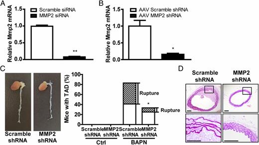 FIGURE 6. Knockdown of C3aR attenuates BAPN-induced formation of TAD. (A) Primary mouse SMCs were transfected with MMP2 or scramble siRNA for 36 h. MMP2 mRNA expression is shown as the fold change compared with the scramble siRNA group after normalization to GAPDH. Data represent the mean ± SEM; three independent experiments were performed. **p < 0.01. (B) C57BL/6 mice were injected with 1011 genome copies of adeno-associated virus (AAV) containing MMP2 shRNA or AAV containing scramble shRNA 3 d before BAPN treatment. At the end of 4 wk of BAPN treatment, MMP2 mRNA expression in aortas was detected and shown as the fold change compared with the AAV scramble shRNA group after normalization to GAPDH; n = 4. *p < 0.05. (C) Representative macroscopic view shows that depletion of C3aR prevents the formation of BAPN-induced TAD. nAAV-scramble shRNA Ctrl = 4, nAAV-MMP2 shRNA Ctrl = 4, nAAV-scramble shRNA BAPN = 12, nAAV-MMP2 shRNA BAPN = 12. *p < 0.05 versus AAV scramble shRNA BAPN for the incidence of TAD. (D) Fragmentation of elastin in thoracic aortas was detected by aldehyde-fuchsin staining; n = 6. Scale bars, 100 μm.