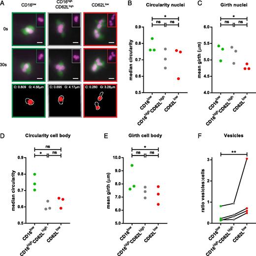 Immature Neutrophils Released in Acute Inflammation Exhibit Efficient