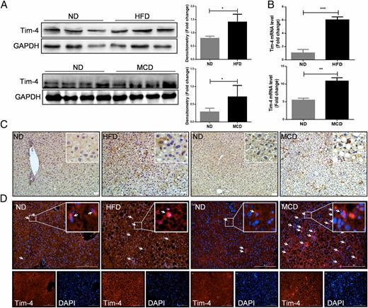 FIGURE 1. Enhanced Tim-4 expression in liver tissues from NAFLD models. Analysis for Tim-4 expression in liver tissues from normal diet (ND) and HFD (left panel) or ND- and MCD diet (right panel)–fed mice through (A) WB for protein level, (B) qPCR for mRNA level. (C) Representative IHC staining of liver tissues with Tim-4 Ab. Scale bar, 50 μm. (D) Representative IF photomicrographs of liver sections with Tim-4 Ab (red) in ND/HFD (left panel) or ND/MCD diet (right panel)–fed mice. Nuclei were stained with DAPI (blue). Scale bar, 200 μm. The box plots in (A) and (B) show the median ± SD. *p < 0.05, **p < 0.01, ***p < 0.001, by two-tailed Student t test.