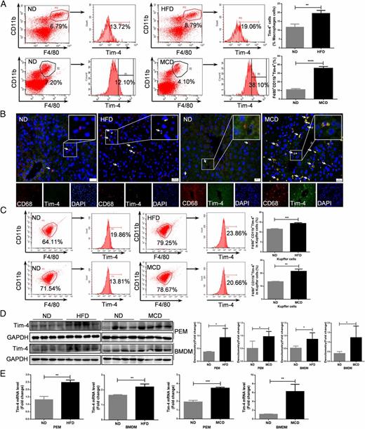 FIGURE 2. Elevated Tim-4 expression in macrophages induced by NAFLD microenvironments. (A) FCM analysis showing the percentage of Tim-4+ in CD11b+ F4/80+ macrophages of normal diet (ND)/HFD-fed mice and ND/MCD diet–fed mice, respectively. (B) Representative IF photomicrographs of costaining with macrophages marker CD68 (red), Tim-4 (green), and nuclei marker DAPI (blue) in liver sections of ND and HFD or ND and MCD mice. Scale bar, 50 μm. (C) FCM analysis showing the percentage of Tim-4 on CD11b+ F4/80+ KCs with the stimulation of LHSs, (culture medium: LHS = 7:3) from ND and HFD or ND and MCD mice for 48 h, respectively. (D) Immunoblot analysis of PEM and BMDM protein lysates for Tim-4 with the stimulation of LHSs from ND and HFD or ND and MCD mice for 48 h, respectively. (E) qPCR analysis for Tim-4 mRNA levels of PEMs and BMDMs stimulated with LHSs from ND and HFD or ND and MCD mice, respectively. The box plots in (A) and (C)–(E) show the median ± SD. *p < 0.05, **p < 0.01, ***p < 0.001, ****p < 0.0001, by two-tailed Student t test.